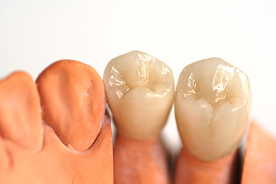 Benecchi Dental Group | Emergency Treatment, Periodontal Treatment and Pediatric Dentistry