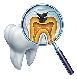 Benecchi Dental Group | Veneers, Extractions and Periodontal Treatment