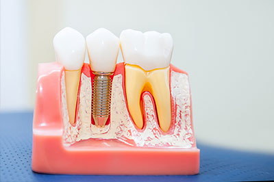Benecchi Dental Group | Pediatric Dentistry, Cosmetic Dentistry and Dental Cleanings