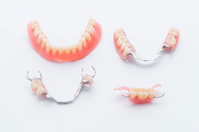 Benecchi Dental Group | Extractions, Pediatric Dentistry and Dental Fillings