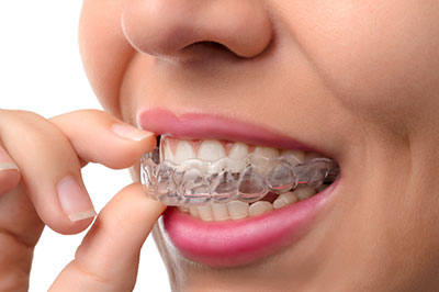 Benecchi Dental Group | Dental Bridges, Pediatric Dentistry and Emergency Treatment