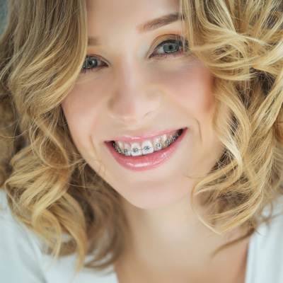 Benecchi Dental Group | Digital Radiography, Veneers and Preventative Program