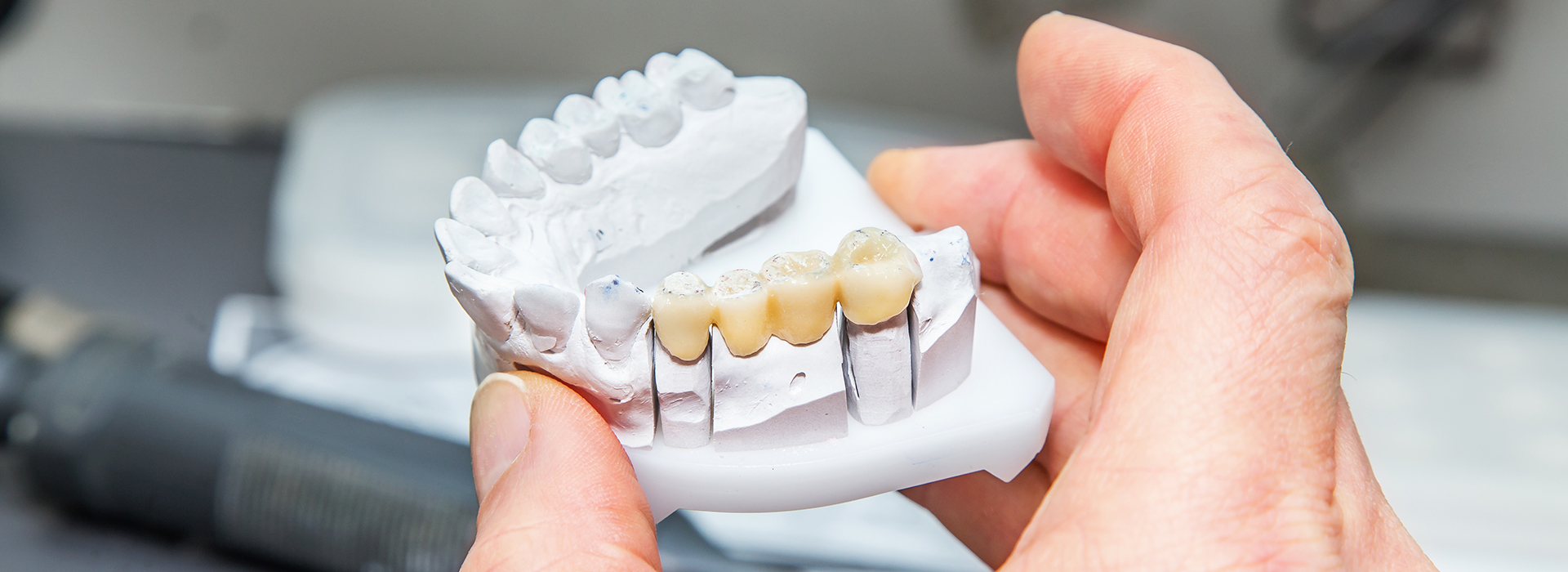 Benecchi Dental Group | Invisalign reg , Oral Exams and Cosmetic Dentistry
