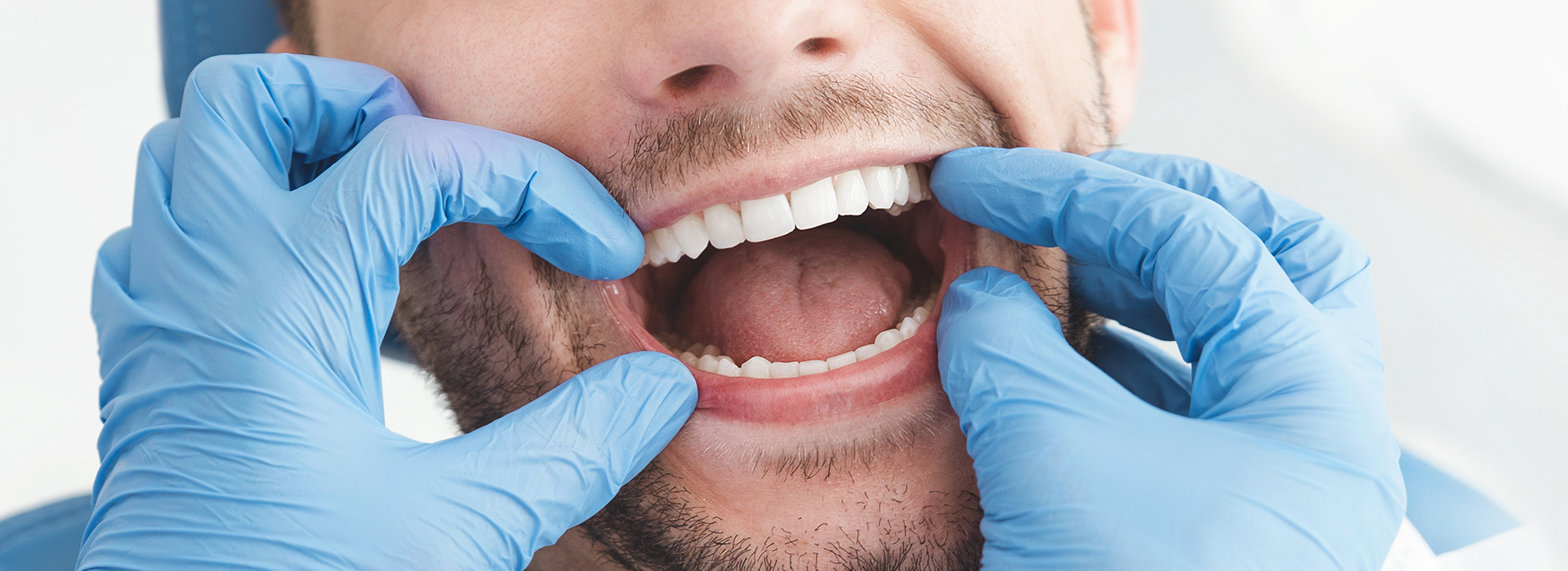 Benecchi Dental Group | Preventative Program, Periodontal Treatment and Invisalign reg 