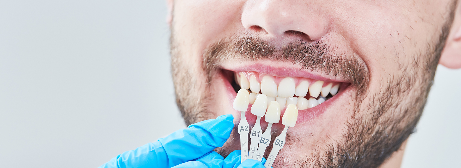 Benecchi Dental Group | iTero   Intraoral Scanner, Extractions and Preventative Program